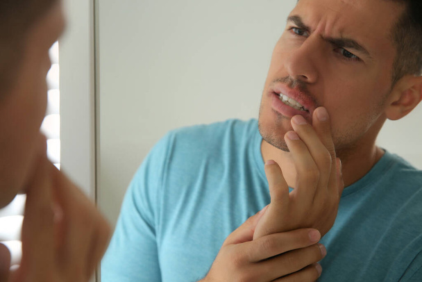 Man with herpes touching lips in front of mirror at home - Foto, Imagen