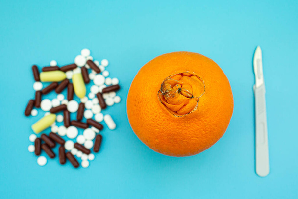 Orangen mit großem Bauchnabel, Pillen, Skalpell auf blauem Hintergrund. Konzept der medizinischen oder chirurgischen Behandlung von Hämorrhoiden - Foto, Bild