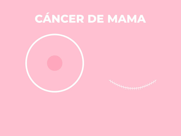 乳がんの手術をコンセプトにしたスペイン語のイラスト。国際的な乳がんの日 - 写真・画像