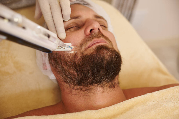 Homem recebendo mesoterapia de alta frequência no salão de beleza. Procedimento para o conceito de rejuvenescimento da pele - Foto, Imagem