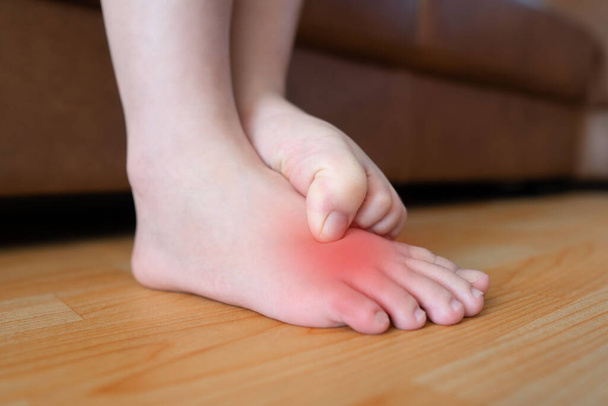 Молода жінка подряпає свербіж на ногах при висипанні. Причиною сверблячої шкіри є нога спортсмена (грибкова інфекція), дерматит (екзема), псоріаз або укуси жуків. Концепція охорони здоров'я
. - Фото, зображення