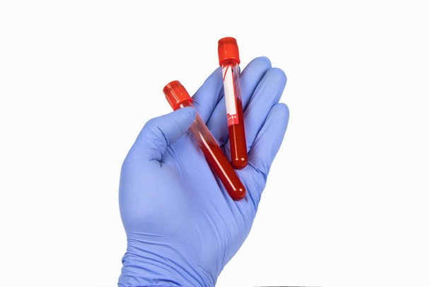 Tubo de ensayo de sujeción manual con plasma sanguíneo listo para análisis. - Foto, imagen