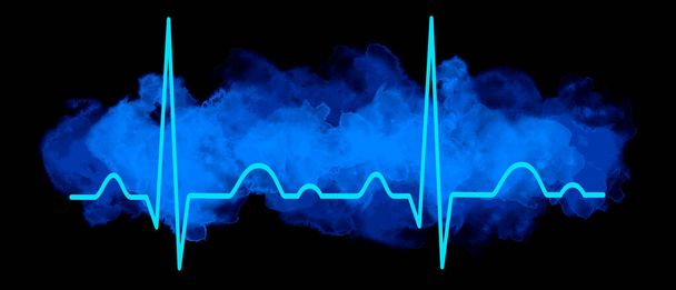 Electrocardiogram graphic in vector quality. - Διάνυσμα, εικόνα