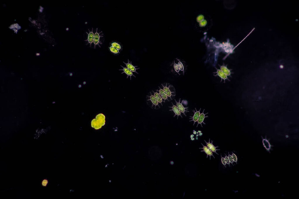 Protozoários e Algas Verdes em águas residuais ao microscópio. - Foto, Imagem