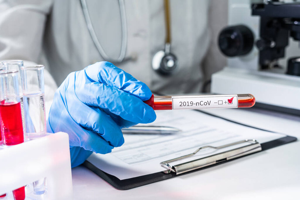 Врач держит в руке пробирку с положительным анализом крови на новый коронавирус 2019 года из Китая. - Фото, изображение