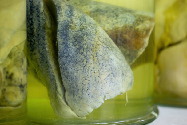 Lungs with cancerous changes floating inside jar with formaldehyde in morgue - Foto, immagini