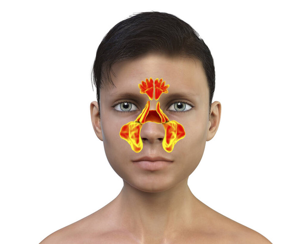 Anatomie des sinus paranasaux. Illustration 3D montrant un adolescent avec des sinus paranasaux surlignés, frontaux, maxillaires, ethmoïdes et sphénoïdes - Photo, image