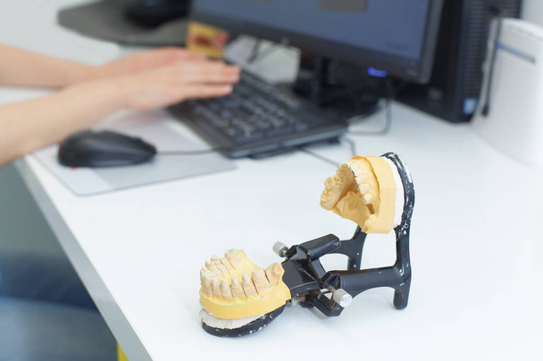 3d scanning and printing of dental prosthesis - Φωτογραφία, εικόνα