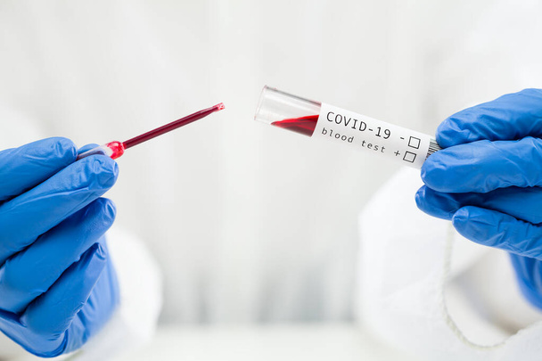 Labortechniker entnimmt Blutprobe im Reagenzglas mittels Pipette, COVID-19 Bluttestverfahren, Detailaufnahme der Hände in Handschuhen zur Aufbewahrung der Probe im Vakuum, serologischer Coronavirus-Test - Foto, Bild