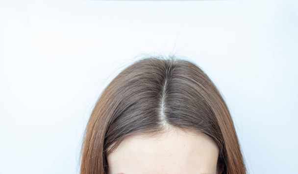 Naisen pään kanssa jakaus harmaita hiuksia, joka on kasvanut juuret takia karanteenia. Ruskeat hiukset naisen pään lähikuva. - Valokuva, kuva