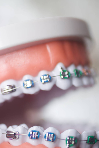 Uchwyt do osiowania zębów stomatologicznych ucznia model pokazujący dziąsła i prostownice do zębów metalowych. - Zdjęcie, obraz