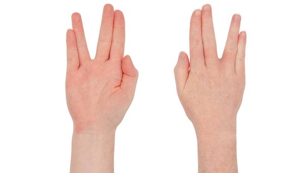 Sommersprossige weiße Hände. Vereinzelte Frauenhand, vorne und hinten, in der Haltung des vulkanischen Grußes mit dem Daumen in der Hand - Foto, Bild