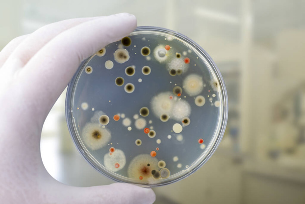 Kolonien verschiedener Bakterien und Schimmelpilze auf Petrischale mit Nährstoffagar, Nahsicht. Hand in Hand weißer Handschuhhalter mit Nährmedium im Forschungslabor - Foto, Bild