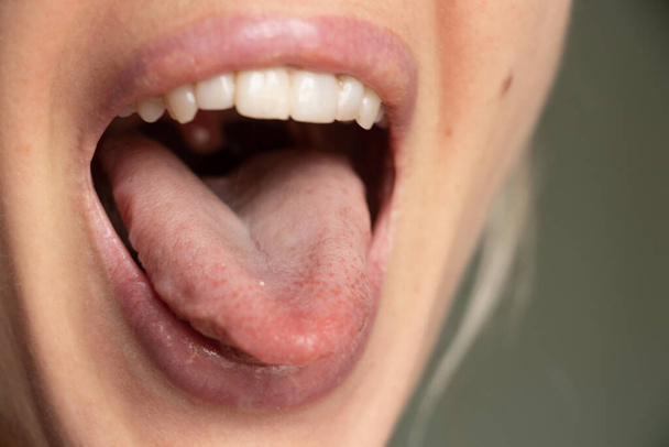 nyitott szájú nyelv ajkak egy fiatal lány közelről - Fotó, kép