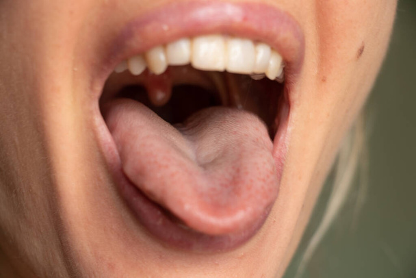 γλώσσα ανοιχτό στόμα χείλη ενός νεαρού κοριτσιού από κοντά - Φωτογραφία, εικόνα