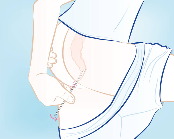 4-insérer l'écouvillon dans le rectum avec la main - Vecteur, image