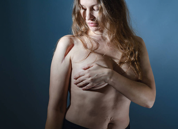 Женщина смотрит на плечо со шрамом на плече после операции на кости. - Фото, изображение