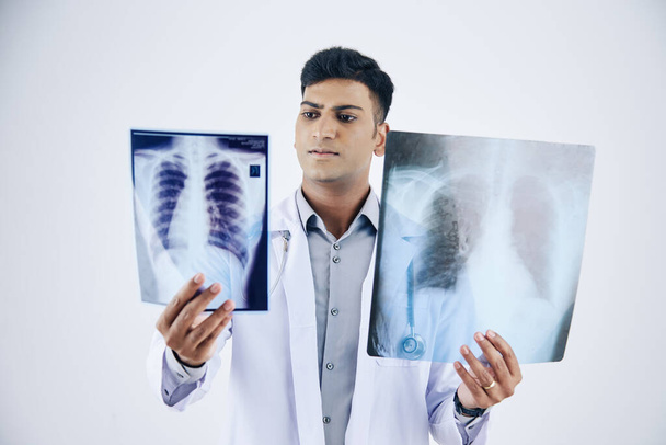 Ciddi genç Hintli doktor iki göğüs röntgeni karşılaştırıyor, beyaz üzerinde izole edilmiş. - Fotoğraf, Görsel