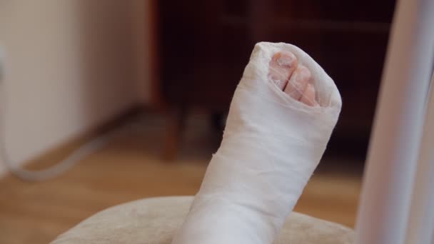 脚の上の石膏キャスト - 映像、動画