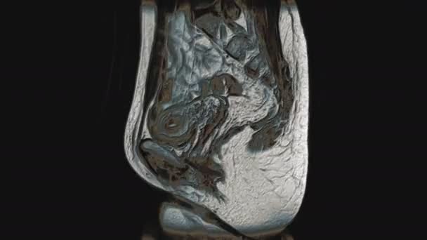 Wielobarwne MRI żeńskich narządów miednicy, jamy brzusznej, przewodu pokarmowego i pęcherza moczowego - Materiał filmowy, wideo
