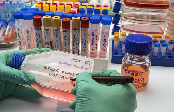 Ученый пишет в флаконе новый вариант вируса ковид-19 из Бразилии, обнаруженный в Миннесоте, концептуальное изображение - Фото, изображение