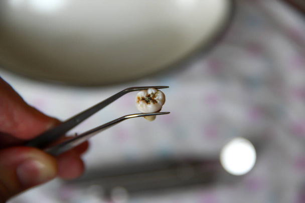 Вырезанный зуб в пинцетах на фоне зубных инструментов - Фото, изображение