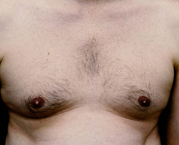 Breast and chest of an adult white male with weight issues, man boobs. Isolated on black background. High quality photo - Fotoğraf, Görsel