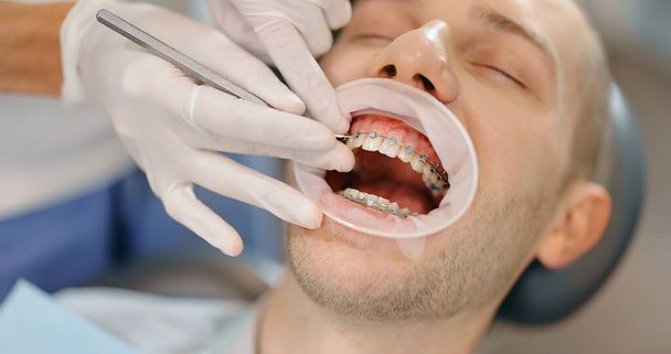 Ασθενής με οδοντικά στηρίγματα κατά τη διάρκεια τακτικής ορθοδοντικής επίσκεψης - Φωτογραφία, εικόνα