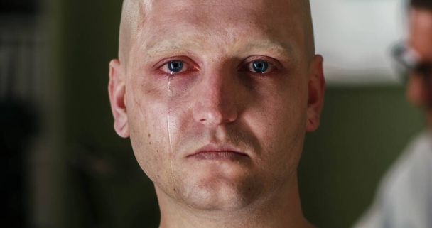 Patient cancéreux en pleurs regardant la caméra - Photo, image