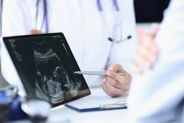 Le médecin démontre l'échographie foetale sur l'écran du comprimé - Photo, image