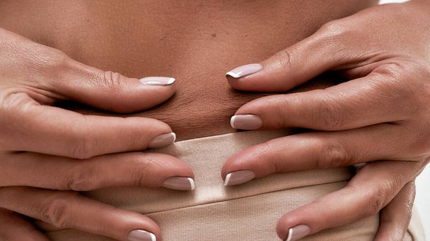 Woman in lingerie showing crumpled skin on waistline - Фото, изображение
