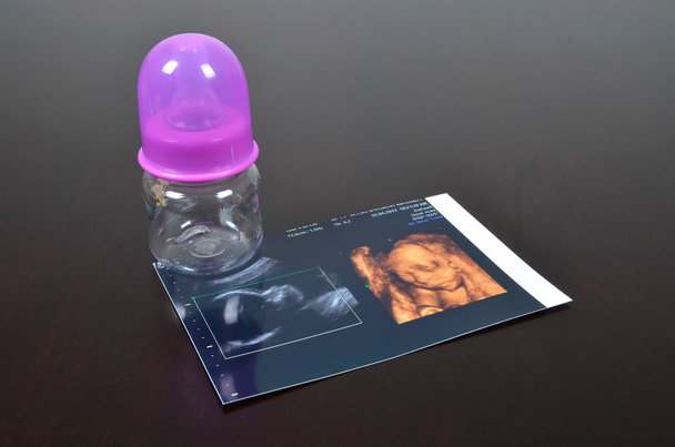 Baby bottle with ultrasound images - Photo, Image