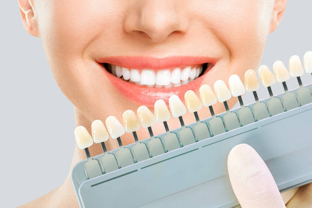 Una joven sonriente. Blanqueamiento dental cosmetológico en una clínica dental. selección del tono del diente del implante - Foto, imagen