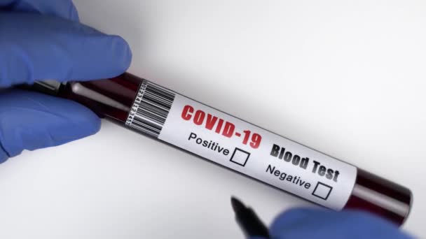 Detailní záběr rukou mikrobiologa v modrých chirurgických rukavicích držících zkumavku pro odběr krve označující výsledek testu jako pozitivní na COVID-19 - Záběry, video