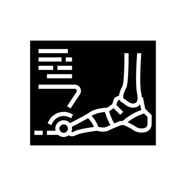 Röntgen-Röntgenaufnahme von Fuß-Gicht-Diesase-Glyphen-Symbol-Vektorillustration - Vektor, Bild