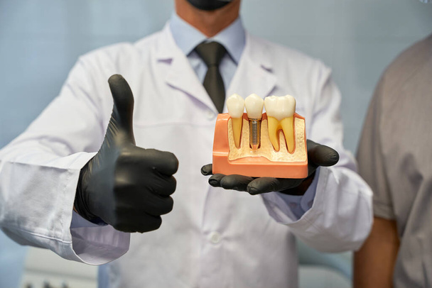 Técnico dental no reconocido posando con modelo de implante dental - Foto, imagen