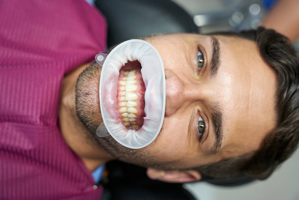 Młody człowiek uśmiecha się szeroko w swoich zaporach dentystycznych - Zdjęcie, obraz