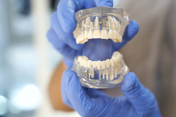 Zahnarzt mit Handschuhen demonstriert Modell menschlicher Zähne - Foto, Bild