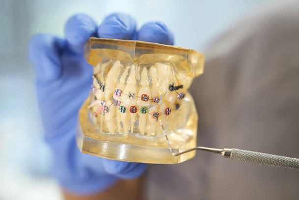 Zahnmediziner zeigt eine Zahnspange am Gebiss - Foto, Bild
