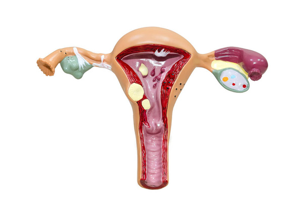 白で単離された女性生殖系のプラスチックモデル。卵巣を持つ子宮の解剖学的モデル。女性の生殖システムの概念。生物学を研究・教育するための設備. - 写真・画像