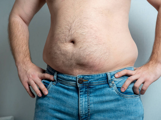 Lihavan miehen paljas vatsa farkuissa. Ylipainoon liittyvät ongelmat - Valokuva, kuva