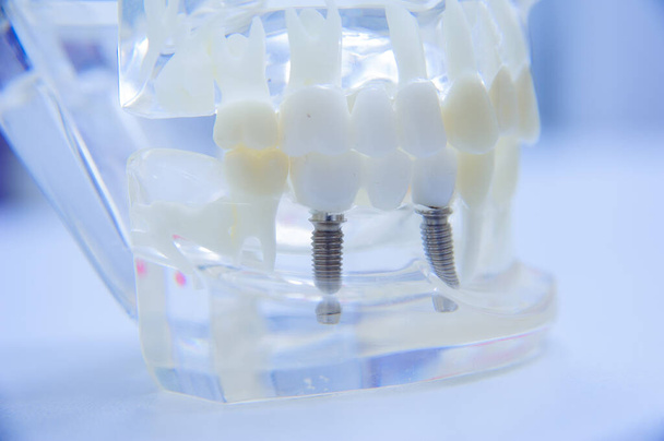 Zubní zubní lékařství student výuky model ukazující zuby, kořeny, dásně, onemocnění dásní, zubní kaz a plak - Fotografie, Obrázek