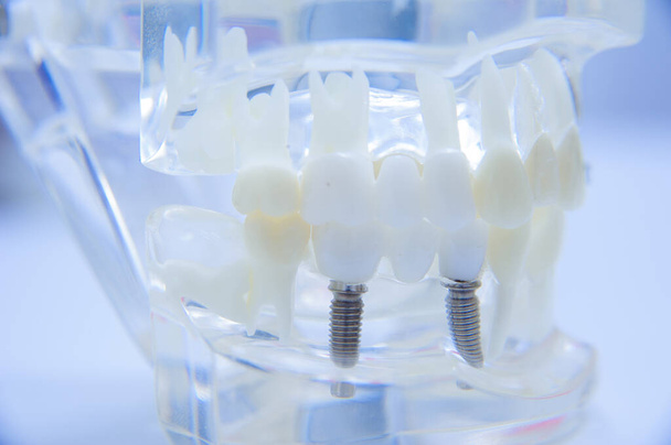 Student stomatologii stomatologicznej uczący się modelu nauczania pokazującego zęby, korzenie, dziąsła, choroby dziąseł, próchnicę zębów i płytkę nazębną - Zdjęcie, obraz