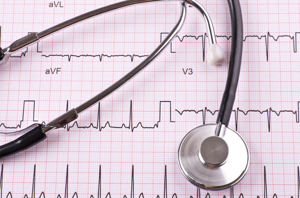 Stethoscope and heart cardiogram - Foto, Imagem