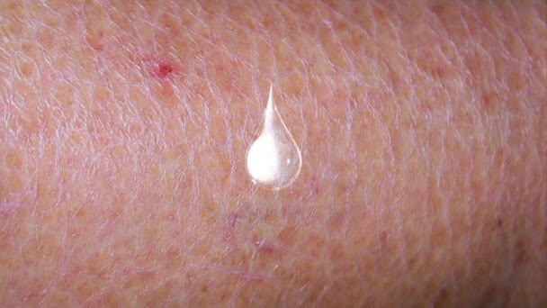 Poner productos para el cuidado de la piel para mejorar la piel agrietada, seca y escamosa a una piel completamente húmeda y saludable - Metraje, vídeo