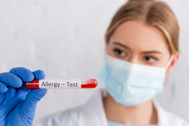 Tubo con letras de prueba de alergia en la mano del médico en máscara médica sobre fondo borroso  - Foto, Imagen