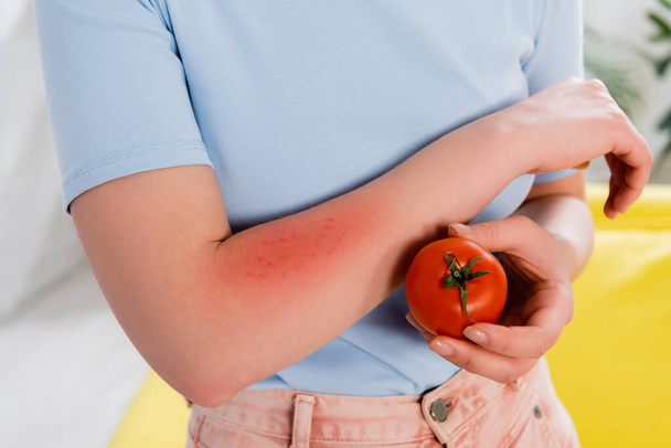 Viljelty näkymä nainen, jolla on allergia tilalla tomaatti  - Valokuva, kuva