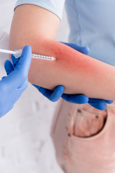 アレルギーのある女性への注射を行う医師の作物ビュー  - 写真・画像