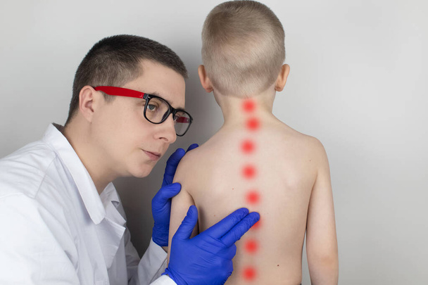 Ein kleiner Junge beim Arzttermin mit Rückenschmerzen. Behandlung von Wirbelsäulendeformität und -beuge. Osteoporose, Kyphose, Lordose oder Skoliose. - Foto, Bild