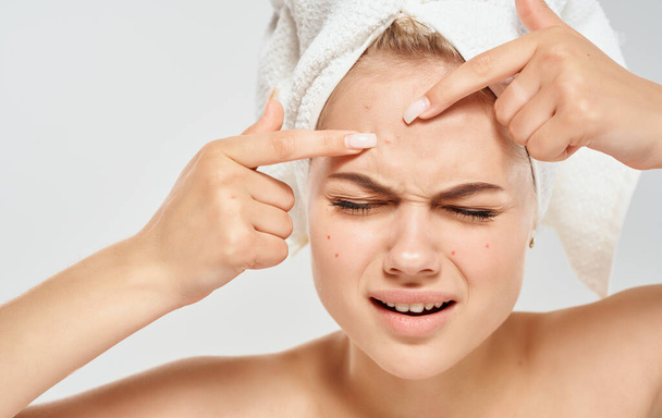 Woman and squeezes pimples on her face problem skin with a towel on her head bare shoulders - Φωτογραφία, εικόνα